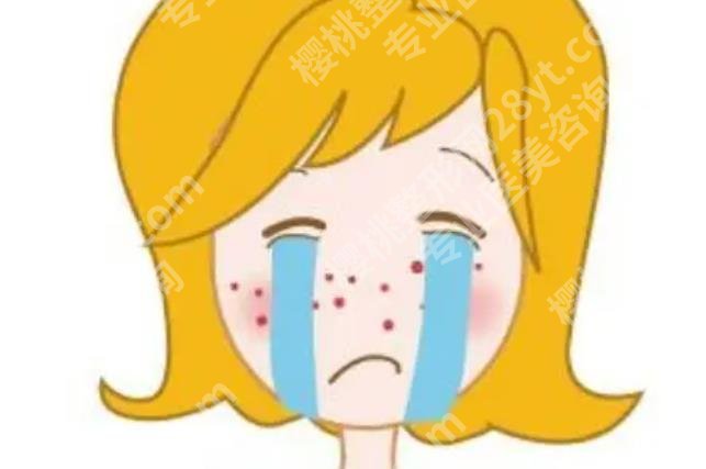 湘潭中心医院美容科祛痘好吗？你想了解的都在这里！