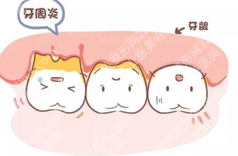 黔东南州人民医院口腔科怎么样？医院口碑及价格表一览！