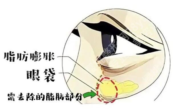 湘潭中心医院整形外科眼袋祛除价格大约是多少？医院简介|全新价格表发布！