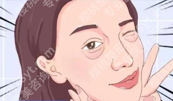 清远人民医院美容中心好不好？医院概况|真人去眼袋日记分享！