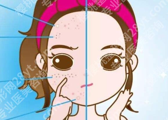 石嘴山第二人民医院整形科怎么样？真人双眼皮案例及价格表更新！