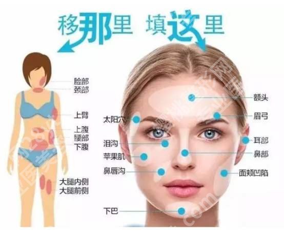 北京艺星自体脂肪面部填充怎么样？医院资料全新展示！附真人案例