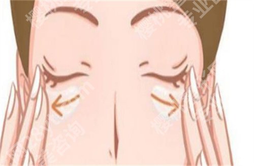 手术祛眼袋的1到8天图片案例分享，恢复细节公开