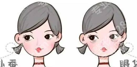 九院许志成内切眼袋多少钱?医生技术成熟收费透明!