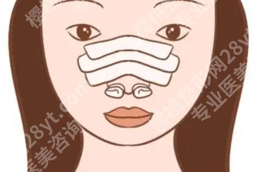 北京十优医疗美容门诊部隆鼻价格贵不贵？隆鼻案例参考