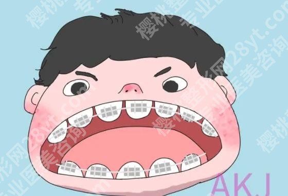 上海华山医院牙齿矫正怎么样？蔡益达医生技术如何？牙齿矫正案例
