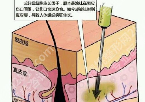 冯立哲取生长因子怎么样？医生实力测评及坐诊医院介绍公布