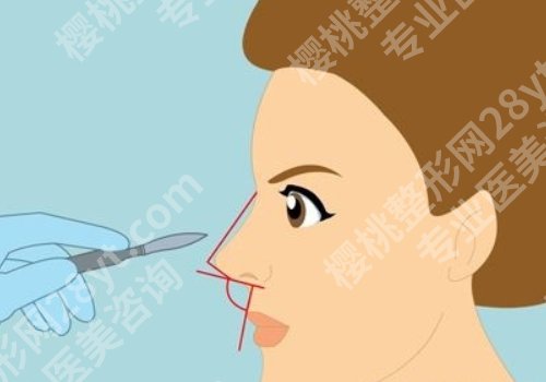北京蒂凡妮王志坚价格合理吗？医生实力及真人案例分享！