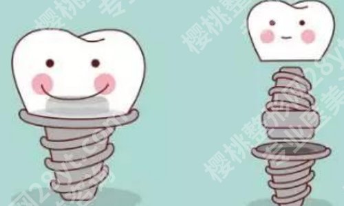 北京维尔口腔种植牙收费标准更新！科室信息与真实评价