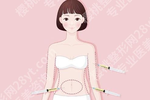 上海俏佳人注射多少钱？院内坐诊医生基本资料介绍！案例参考