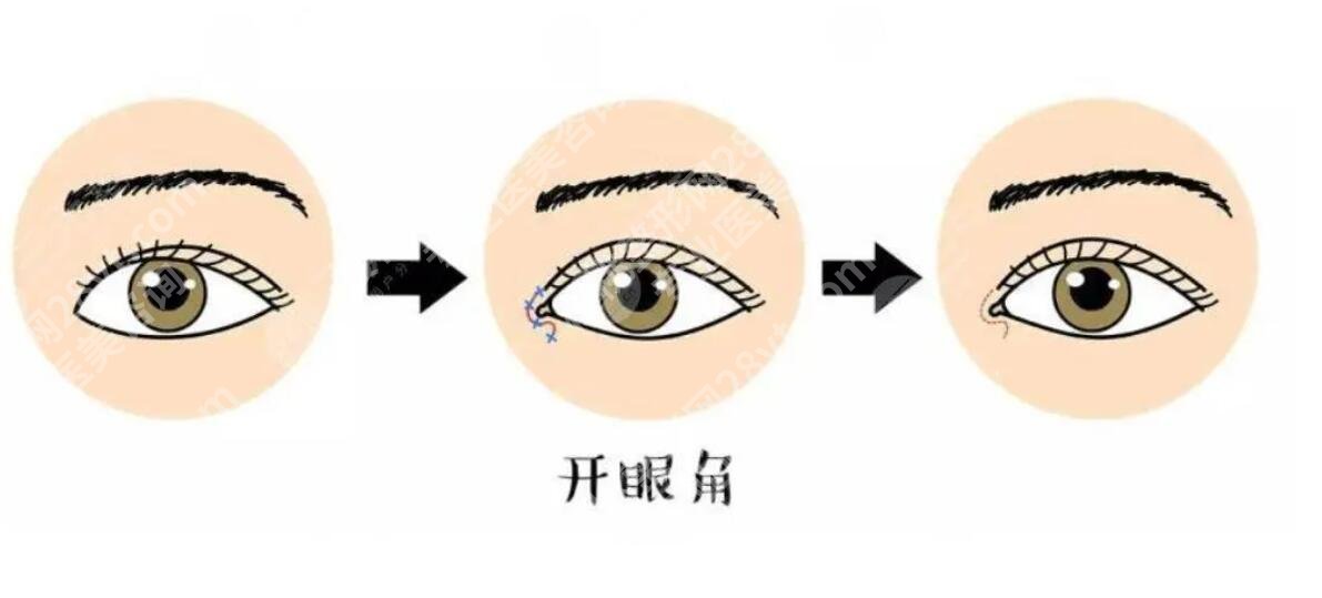 北京华韩医疗美容双眼皮多少钱？医院信息|开设项目介绍！