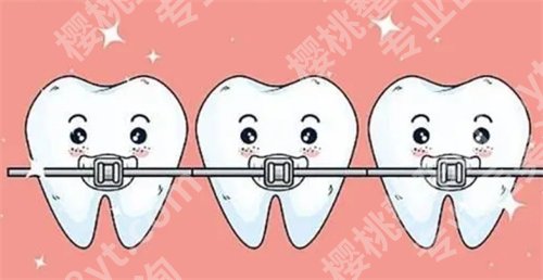 北大口腔医院牙齿矫正医生有谁？看明星项目介绍，案例反馈