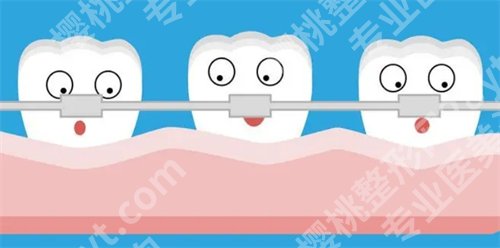 北京英迪口腔正畸费用是多少？真实案例，见证改变