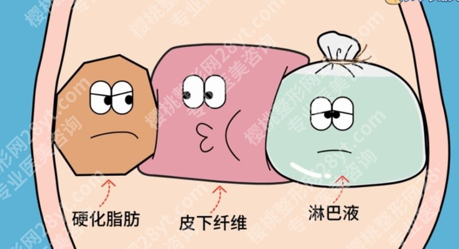 北京画美吸脂好的医生|王慧文/任召磊/马群等医生基本资料介绍！