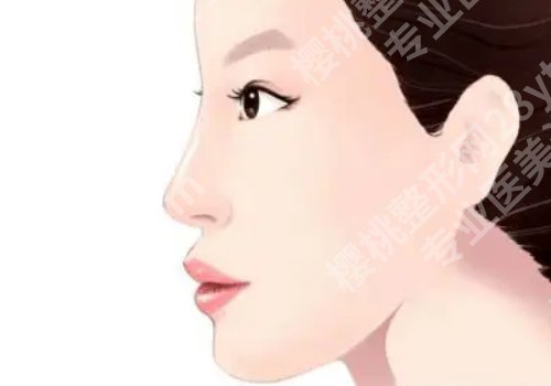 泉州第一医院隆鼻面诊攻略汇总公布！医生风格特点一览