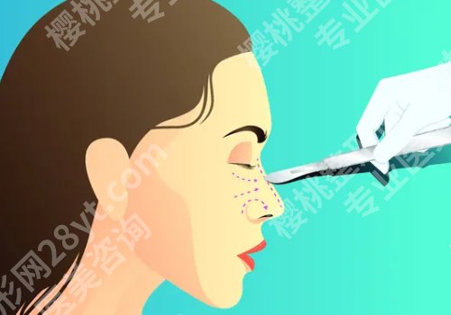 北京同仁医院隆鼻面诊攻略汇总！内附全新隆鼻案例！