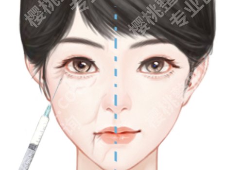 武晓莉亲自做手术吗?医生优势和体验反馈展示
