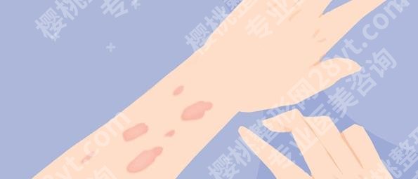 九院武晓莉号可以现场挂号么？武医生技术点评|真人案例参考