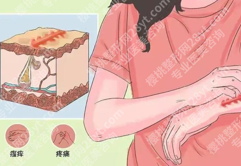 常州第一人民医院整形外科口碑怎么样？祛疤真人效果图展示！
