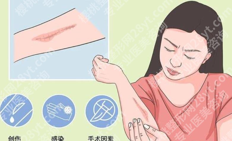 常州第一人民医院整形外科口碑怎么样？祛疤真人效果图展示！