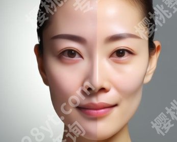 北京美天医疗美容抗衰价格贵不贵？医院项目推荐！真实案例