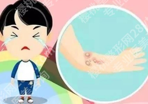 武晓莉疤痕手术收费标准贵吗?内附医生介绍及真实顾客点评 