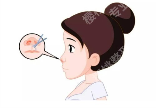 泉州第一医院整形科肋骨鼻多少钱？顾客点评反馈来了，点击一览