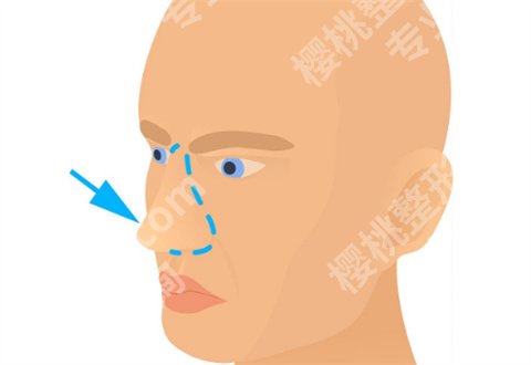 长春吉大二院整形科怎么样？案例展示，热门项目敬请收看