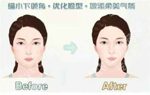 上海第六人民医院整形美容怎么样？点击预约医院简介、项目推荐