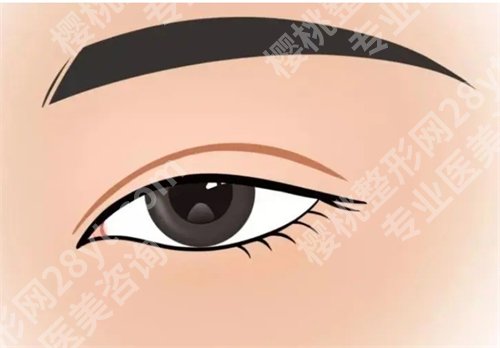 乌鲁木齐伊丽莎白整形医院周龙做的双眼皮怎么样？案例出炉了