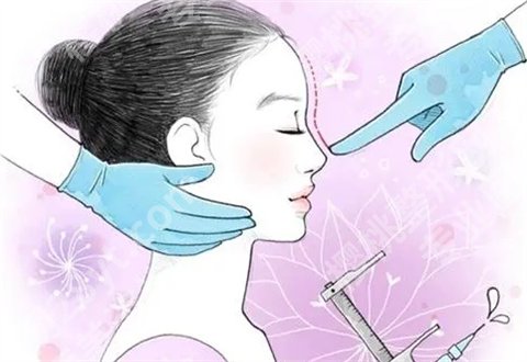 李竞医生做鼻子怎么样？坐诊医院是哪？日记反馈了