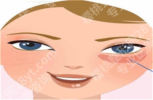 嘉兴盛熙妍整形医院怎么样？医院信息介绍，去眼袋案例分享