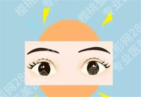 金式伦割双眼皮怎么样？个人资料即将公开，附案例蜕变