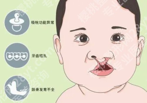 上海范锴做唇裂鼻畸形修复怎么样?医生基本信息及近期案例反馈公布