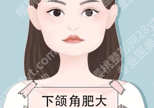上海九院柴岗怎么样？医生技术、口碑点评一览