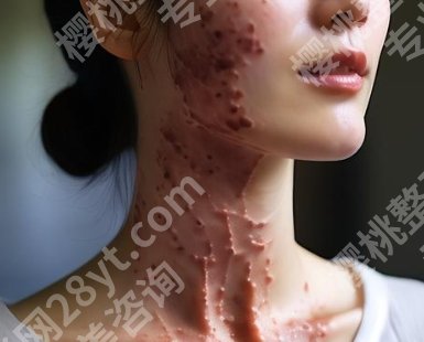 常州一院整形科刘小舒实力如何？经典案例|见证TA的蜕变