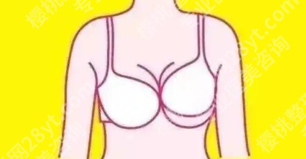 上海美莱和华美哪个医院更好？两家医院实力评比！