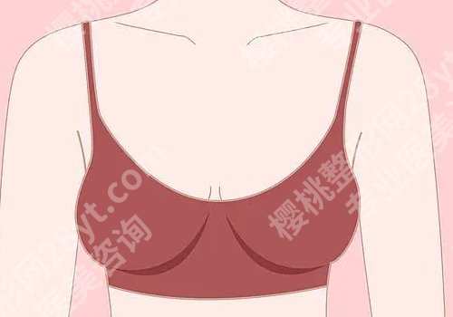 郝永生做的隆胸怎么样？医生简介与隆胸案例详情