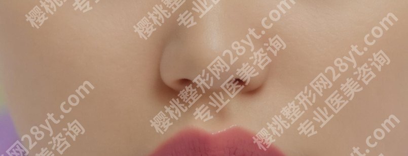 上海张贺医生做人中怎么样？人中整形费用及案例分享