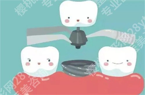 太仓康雅口腔门诊种牙怎么样?简介公布,看价格