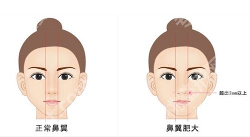 西安画美口碑怎么样？口碑在线点评，项目大公开