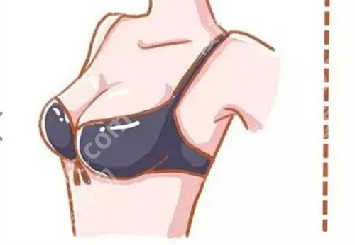 保定蓝山做胸怎么样？特色项目来袭