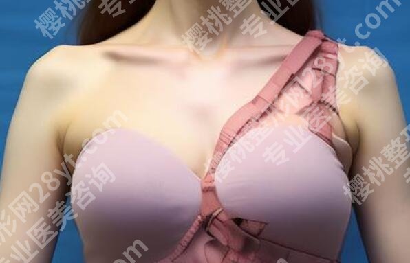 九院假体隆胸手术多少钱啊？详细地址、全新价目表更新！