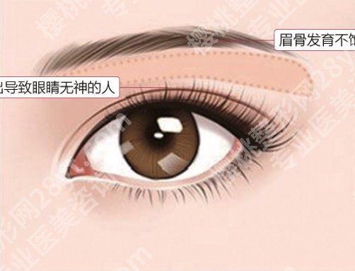 吴佳君医生眉弓的技术好不好？相关项目疑问解答