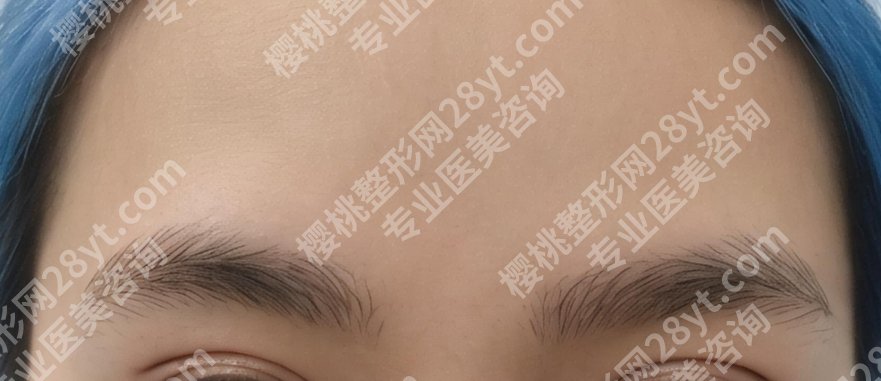 吴佳君医生简介|关于医生的真实口碑点评来袭！案例鉴赏