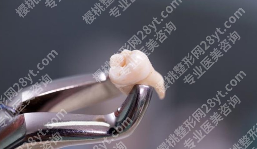 成都华西口腔医院拔牙价格贵不贵？一颗牙参考价多少？