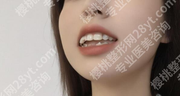 深圳口腔医院牙齿美白价格贵不贵？医院信息|项目价格点评！