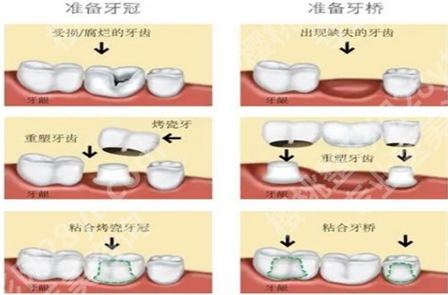 北京廷杰口腔诊所怎么样？主打项目+收费介绍