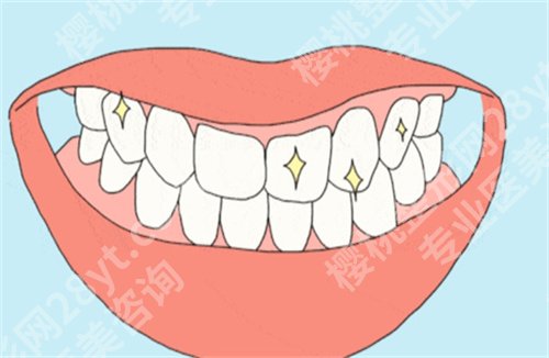 北京杰康口腔种牙价格？医院详情介绍，实力曝光