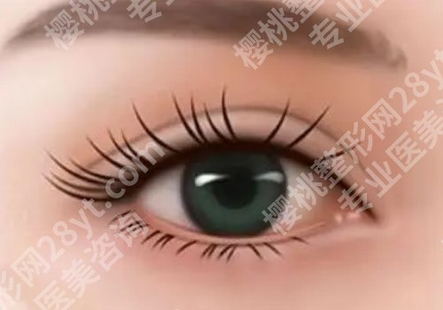 黄惠真双眼皮技术怎么样? 网友反馈及近期案例曝光 